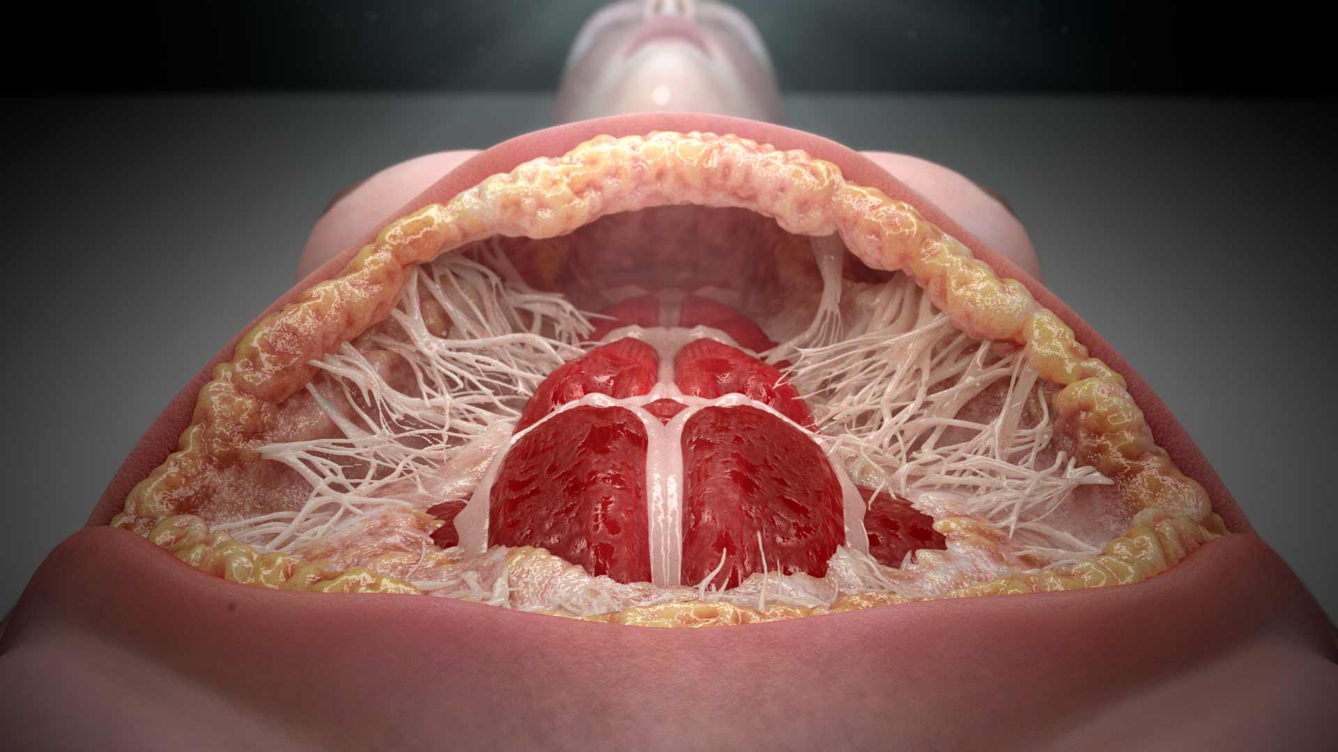 Animación 3D Abdominoplastia – Dr. Buccheri | Pixel Medical Animation