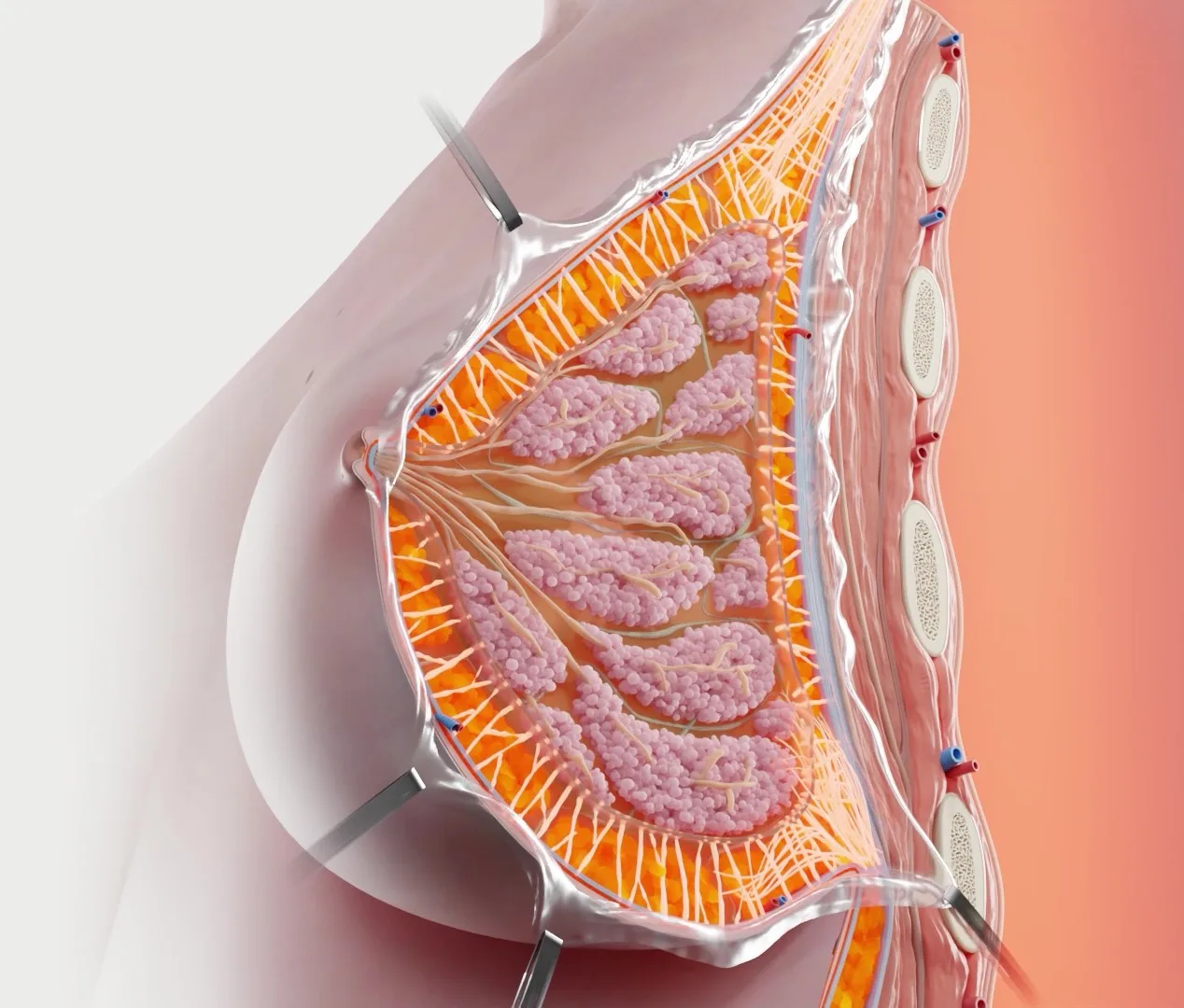 Medical presentation on breast surgery
