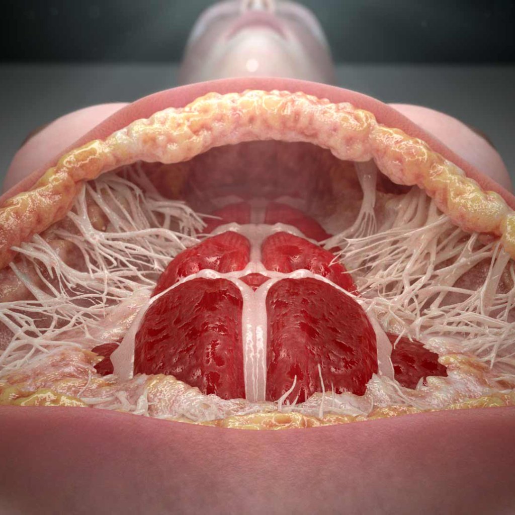 Renuvion Summit 3D surgery project, Clinica J.Mir